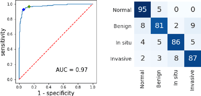 Figure 4 for Deep Convolutional Neural Networks for Breast Cancer Histology Image Analysis