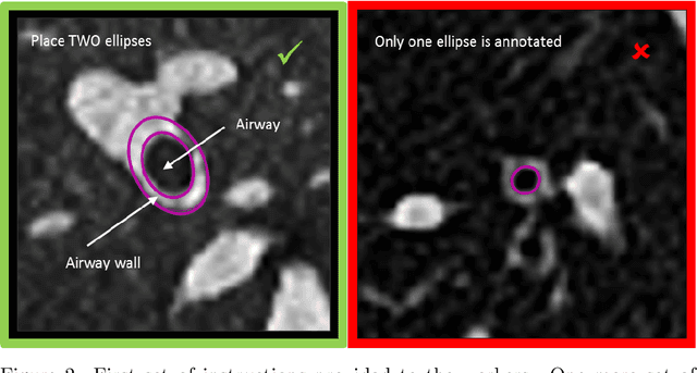 Figure 2 for Crowdsourcing Airway Annotations in Chest Computed Tomography Images