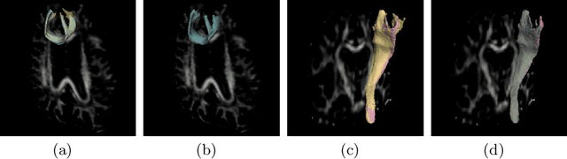 Figure 4 for Reproducible White Matter Tract Segmentation Using 3D U-Net on a Large-scale DTI Dataset