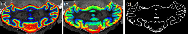 Figure 2 for Grey matter sublayer thickness estimation in themouse cerebellum