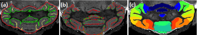 Figure 3 for Grey matter sublayer thickness estimation in themouse cerebellum