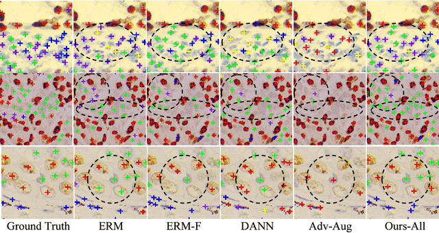 Figure 4 for Generalizing Nucleus Recognition Model in Multi-source Images via Pruning