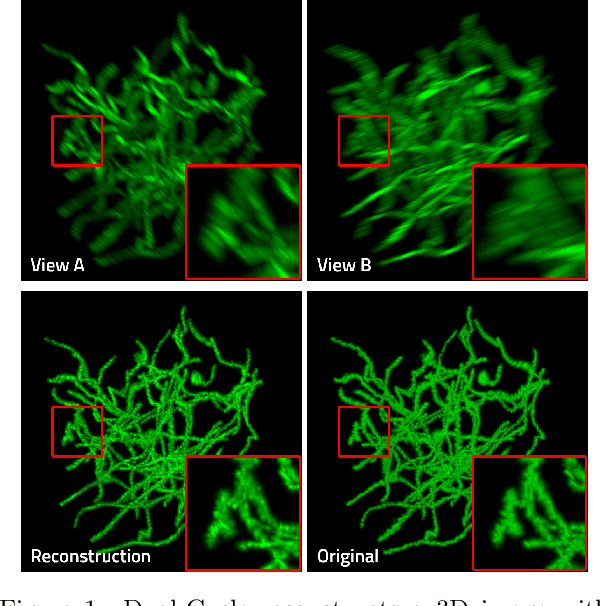 Figure 1 for Dual-Cycle: Self-Supervised Dual-View Fluorescence Microscopy Image Reconstruction using CycleGAN