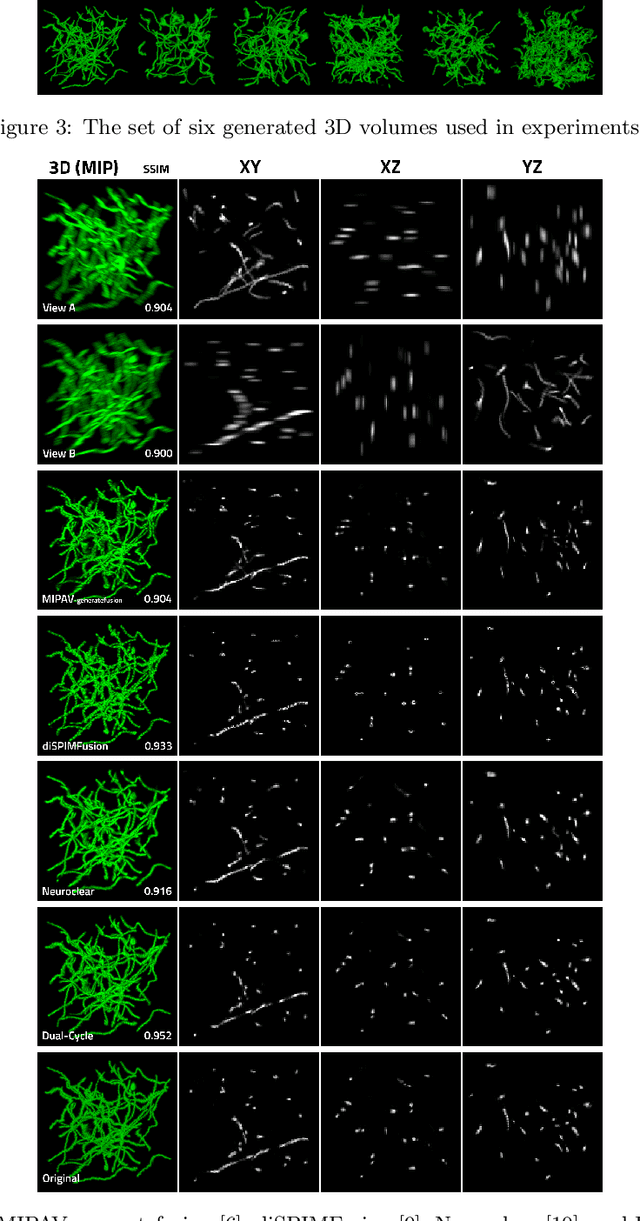 Figure 4 for Dual-Cycle: Self-Supervised Dual-View Fluorescence Microscopy Image Reconstruction using CycleGAN