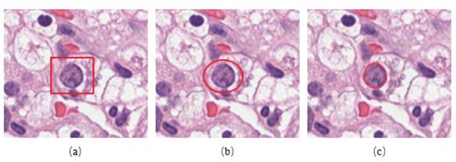 Figure 1 for Effects of annotation granularity in deep learning models for histopathological images