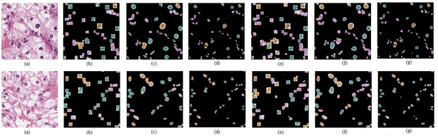 Figure 3 for Effects of annotation granularity in deep learning models for histopathological images