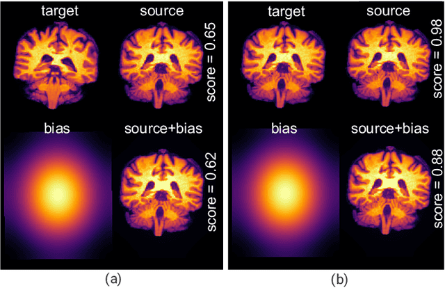 Figure 3 for Exploring Intensity Invariance in Deep Neural Networks for Brain Image Registration