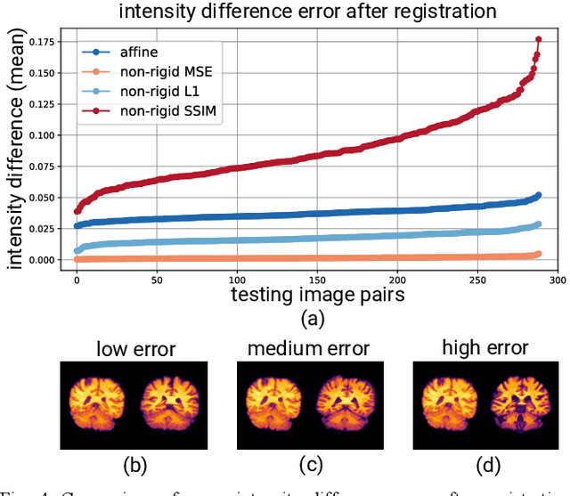 Figure 4 for Exploring Intensity Invariance in Deep Neural Networks for Brain Image Registration