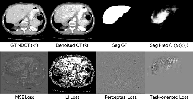 Figure 3 for Task-Oriented Low-Dose CT Image Denoising