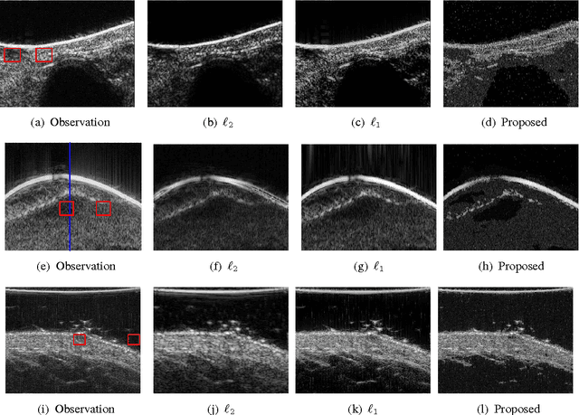 Figure 2 for Joint Segmentation and Deconvolution of Ultrasound Images Using a Hierarchical Bayesian Model based on Generalized Gaussian Priors