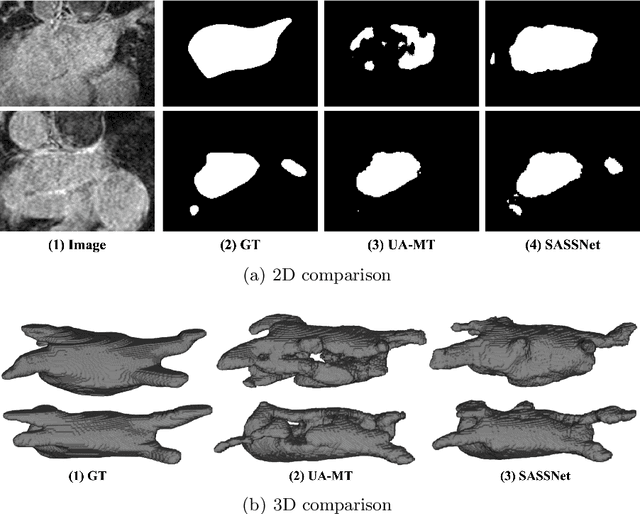 Figure 3 for Shape-aware Semi-supervised 3D Semantic Segmentation for Medical Images