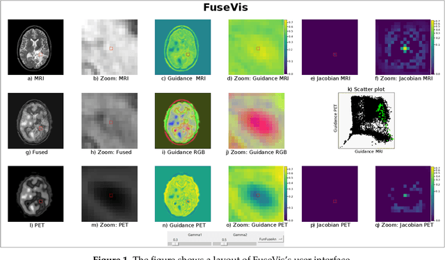 Figure 1 for FuseVis: Interpreting neural networks for image fusion using per-pixel saliency visualization