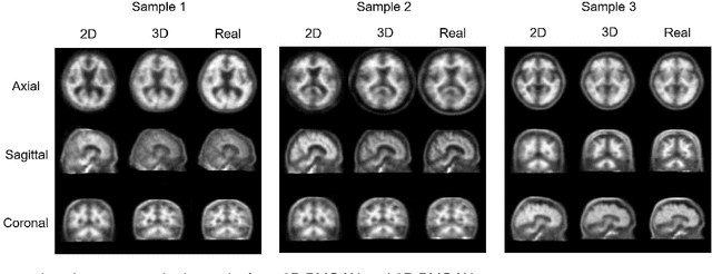 Figure 4 for Bidirectional Mapping Generative Adversarial Networks for Brain MR to PET Synthesis