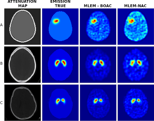 Figure 3 for A Bayesian Optimization Approach for Attenuation Correction in SPECT Brain Imaging