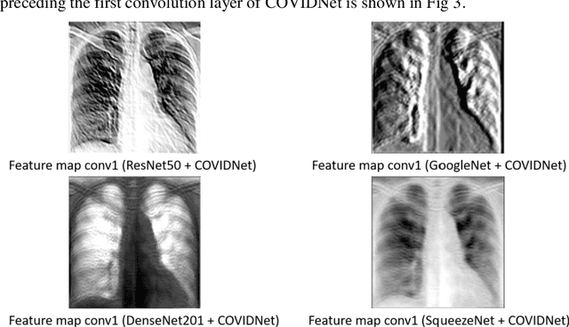 Figure 3 for Triage of Potential COVID-19 Patients from Chest X-ray Images using Hierarchical Convolutional Networks