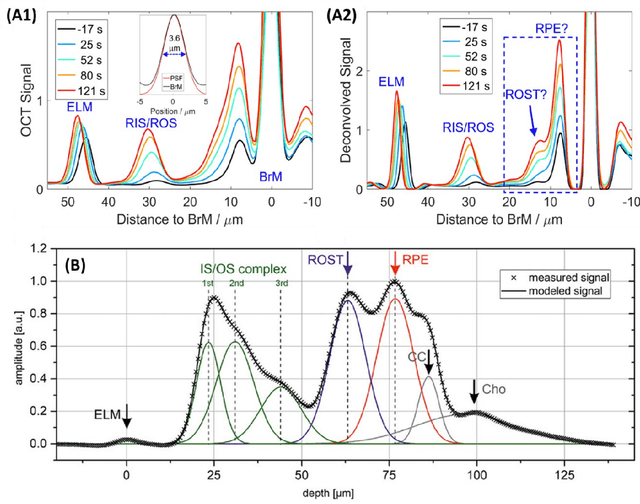 Figure 3 for Functional Optical Coherence Tomography for Intrinsic Signal Optoretinography: Recent Developments and Deployment Challenges