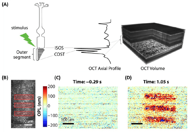 Figure 4 for Functional Optical Coherence Tomography for Intrinsic Signal Optoretinography: Recent Developments and Deployment Challenges
