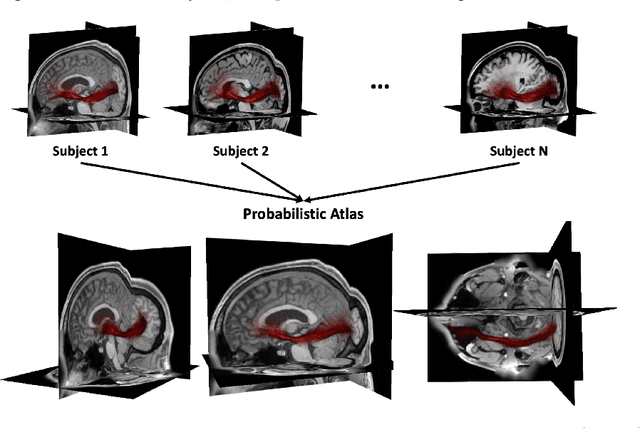 Figure 3 for Fast and Scalable Optimal Transport for Brain Tractograms