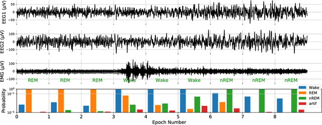 Figure 1 for Automated Classification of Sleep Stages and EEG Artifacts in Mice with Deep Learning