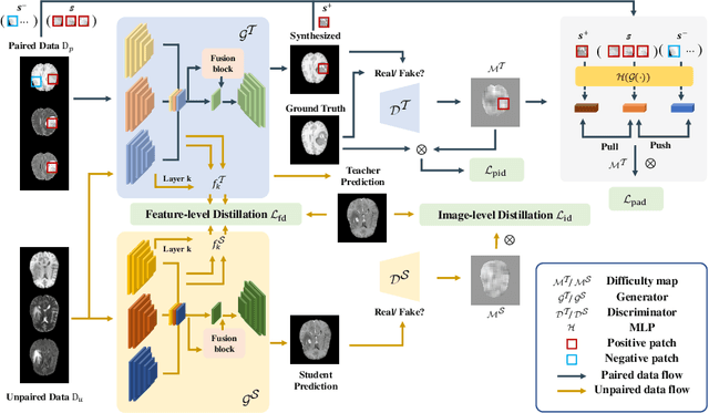 Figure 1 for DS3-Net: Difficulty-perceived Common-to-T1ce Semi-Supervised Multimodal MRI Synthesis Network