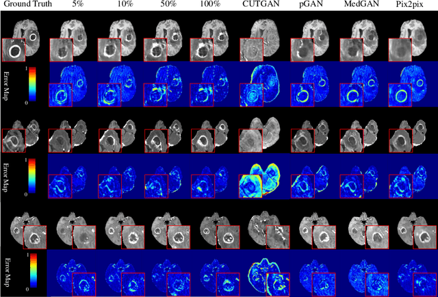 Figure 4 for DS3-Net: Difficulty-perceived Common-to-T1ce Semi-Supervised Multimodal MRI Synthesis Network