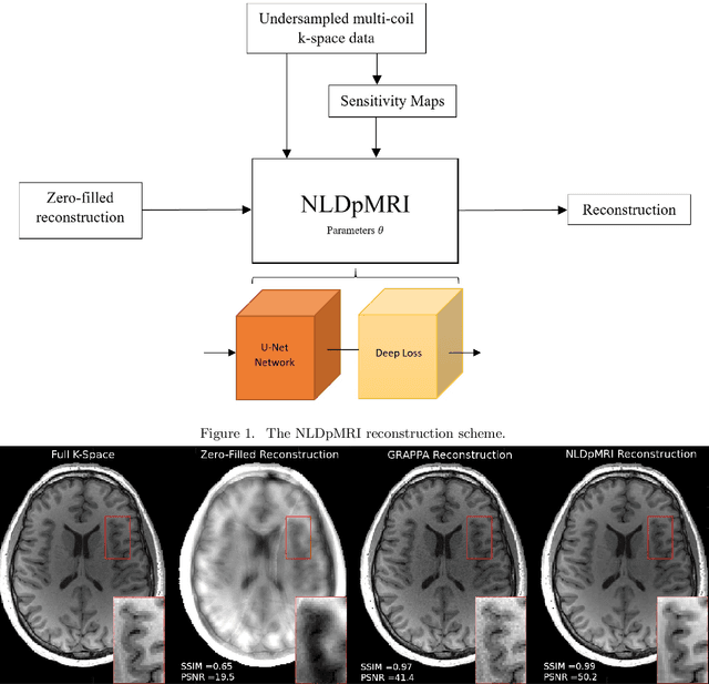 Figure 1 for Non-Learning based Deep Parallel MRI Reconstruction (NLDpMRI)