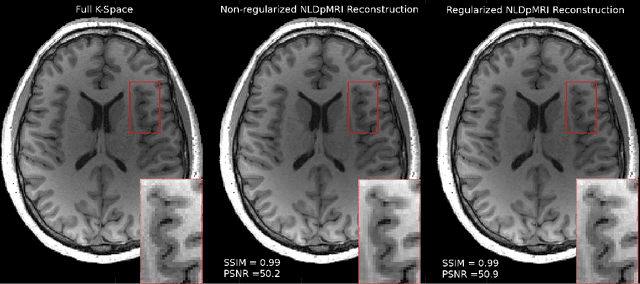 Figure 3 for Non-Learning based Deep Parallel MRI Reconstruction (NLDpMRI)