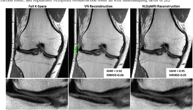 Figure 4 for Non-Learning based Deep Parallel MRI Reconstruction (NLDpMRI)
