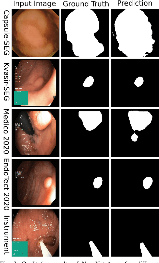 Figure 3 for NanoNet: Real-Time Polyp Segmentation in Video Capsule Endoscopy and Colonoscopy
