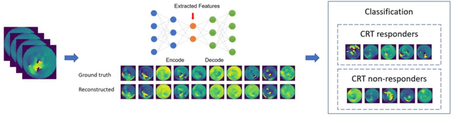 Figure 1 for A method using deep learning to discover new predictors of CRT response from mechanical dyssynchrony on gated SPECT MPI