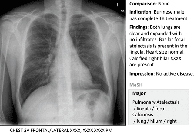 Figure 1 for Learning to Read Chest X-Rays: Recurrent Neural Cascade Model for Automated Image Annotation