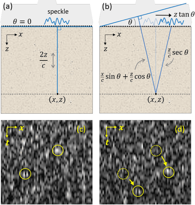 Figure 1 for Ultrasound differential phase contrast using backscattering and the memory effect
