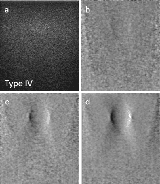 Figure 3 for Ultrasound differential phase contrast using backscattering and the memory effect