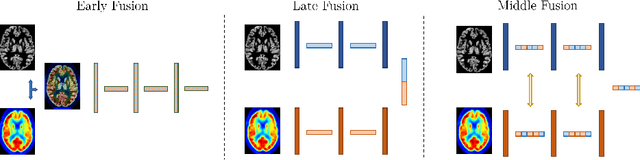 Figure 1 for Is a PET all you need? A multi-modal study for Alzheimer's disease using 3D CNNs