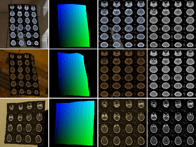 Figure 1 for CT Film Recovery via Disentangling Geometric Deformation and Illumination Variation: Simulated Datasets and Deep Models