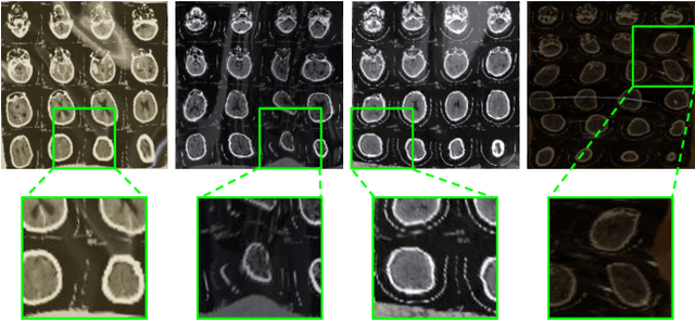 Figure 3 for CT Film Recovery via Disentangling Geometric Deformation and Illumination Variation: Simulated Datasets and Deep Models
