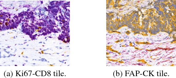 Figure 1 for Virtualization of tissue staining in digital pathology using an unsupervised deep learning approach