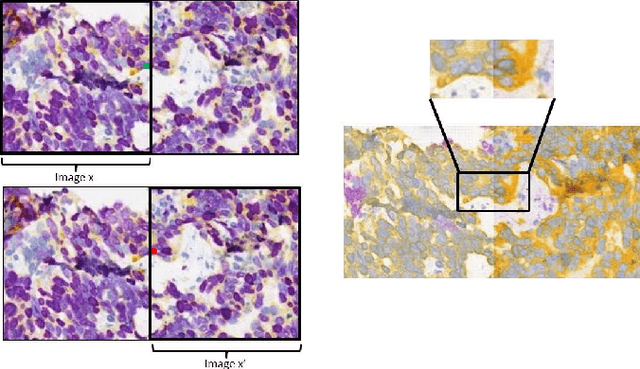 Figure 2 for Virtualization of tissue staining in digital pathology using an unsupervised deep learning approach