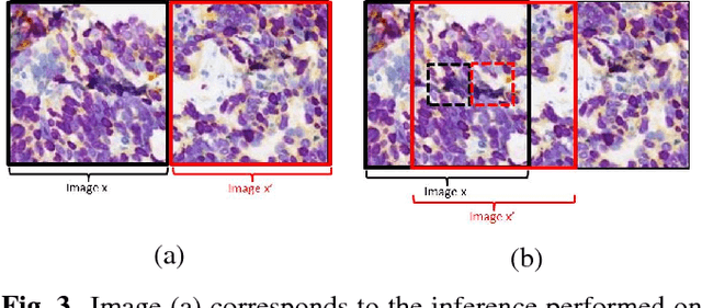 Figure 3 for Virtualization of tissue staining in digital pathology using an unsupervised deep learning approach