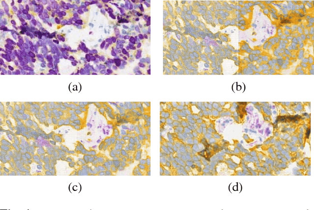 Figure 4 for Virtualization of tissue staining in digital pathology using an unsupervised deep learning approach