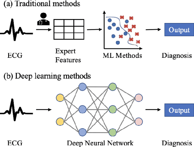 Figure 1 for Interpretable Deep Learning for Automatic Diagnosis of 12-lead Electrocardiogram