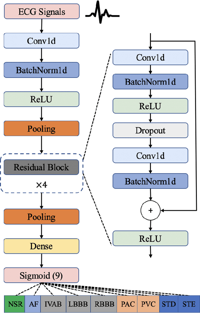 Figure 2 for Interpretable Deep Learning for Automatic Diagnosis of 12-lead Electrocardiogram