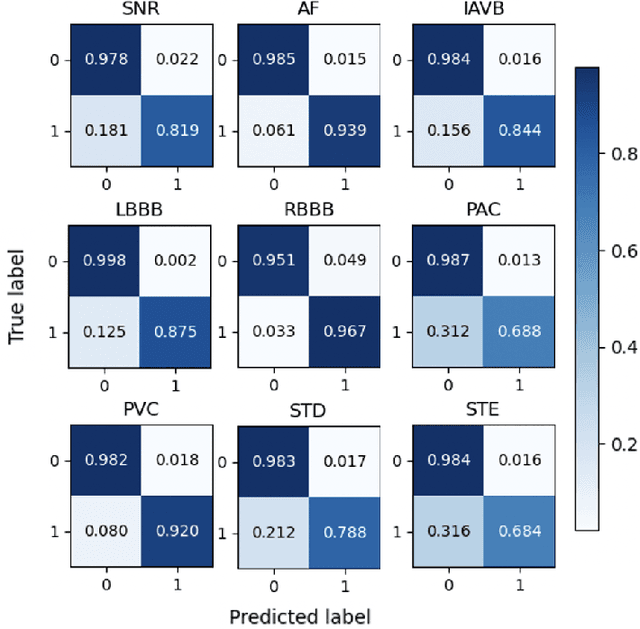 Figure 4 for Interpretable Deep Learning for Automatic Diagnosis of 12-lead Electrocardiogram