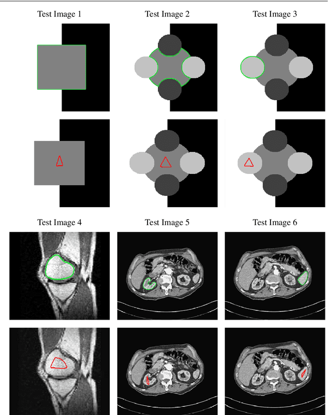 Figure 4 for Chan-Vese Reformulation for Selective Image Segmentation