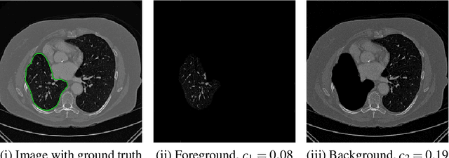 Figure 1 for Chan-Vese Reformulation for Selective Image Segmentation
