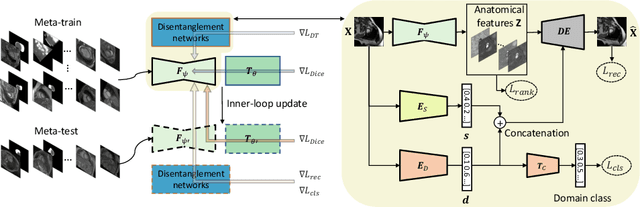 Figure 1 for Semi-supervised Meta-learning with Disentanglement for Domain-generalised Medical Image Segmentation