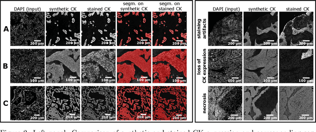 Figure 2 for Novel Deep Learning Approach to Derive Cytokeratin Expression and Epithelium Segmentation from DAPI