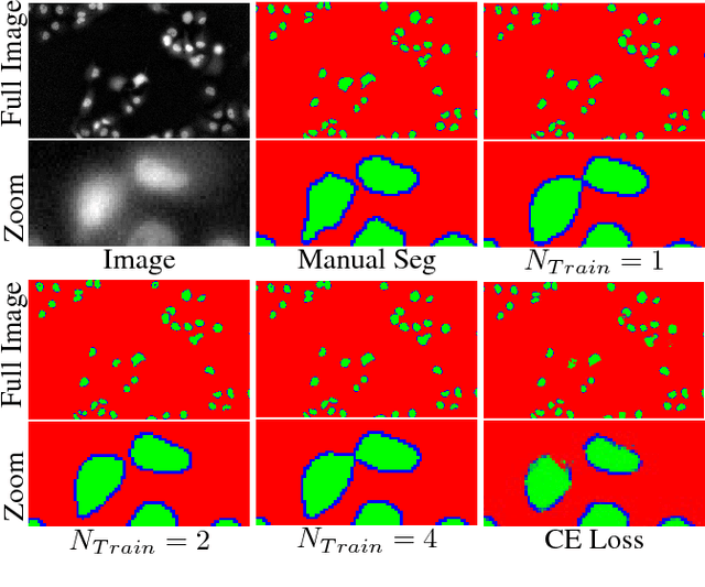 Figure 4 for Microscopy Cell Segmentation via Adversarial Neural Networks