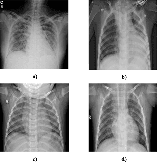 Figure 2 for Effect of Different Batch Size Parameters on Predicting of COVID19 Cases