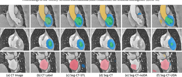 Figure 4 for Unsupervised Cross-Modality Domain Adaptation of ConvNets for Biomedical Image Segmentations with Adversarial Loss